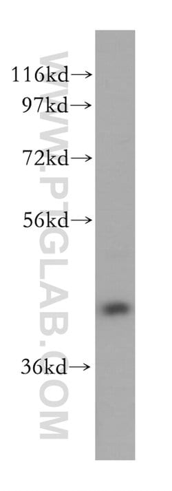 RAB3IL1 Rabbit anti-Human, Mouse, Rat, Polyclonal, Proteintech 150 &mu;L;