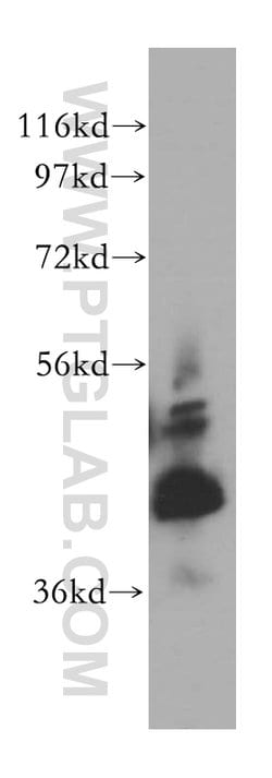 RAB3IL1 Rabbit anti-Human, Mouse, Rat, Polyclonal, Proteintech 150 &mu;L;