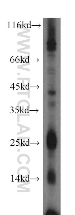 IL3 Rabbit anti-Human, Polyclonal, Proteintech:Antibodies:Primary Antibodies