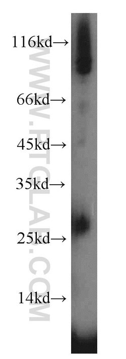 IL3 Rabbit anti-Human, Polyclonal, Proteintech:Antibodies:Primary Antibodies