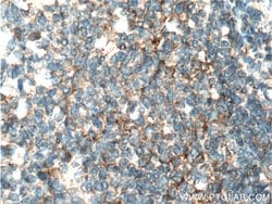 IL3 Rabbit anti-Human, Polyclonal, Proteintech:Antibodies:Primary Antibodies