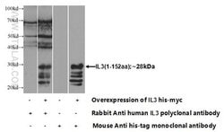 IL3 Rabbit anti-Human, Polyclonal, Proteintech:Antibodies:Primary Antibodies