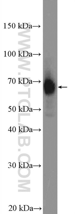P2RX3 Rabbit anti-Human, Mouse, Rat, Polyclonal, Proteintech 150 &mu;L | Buy Online | Proteintech Group Inc | Fisher Scientific