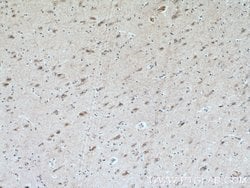 CHRNB2 Rabbit anti-Human, Mouse, Rat, Polyclonal, Proteintech 20 &mu;L;