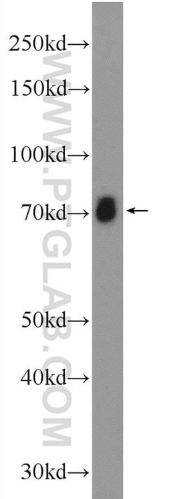 ASIC2 Rabbit anti-Human, Mouse, Rat, Polyclonal, Proteintech 150 &mu;L;