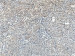 Thumbnail_TNFSF8 Rabbit anti-Human, Mouse, Rat, Polyclonal, Proteintech:Anticorps:Anticorps