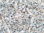 Thumbnail_TNFSF8 Rabbit anti-Human, Mouse, Rat, Polyclonal, Proteintech:Anticorps:Anticorps