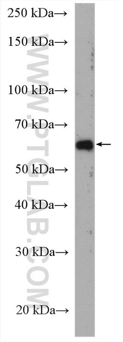 USP21 Rabbit anti-Human, Polyclonal, Proteintech 20 &mu;L; Unconjugated 