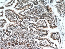 GCS1 Rabbit anti-Human, Mouse, Rat, Polyclonal, Proteintech 150 &mu;L;