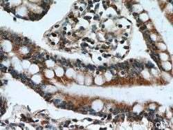 GCS1 Rabbit anti-Human, Mouse, Rat, Polyclonal, Proteintech 150 &mu;L;