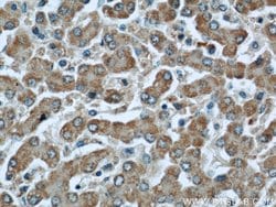 GCS1 Rabbit anti-Human, Mouse, Rat, Polyclonal, Proteintech 150 &mu;L;