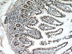 GCS1 Rabbit anti-Human, Mouse, Rat, Polyclonal, Proteintech 150 &mu;L;