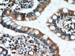 GCS1 Rabbit anti-Human, Mouse, Rat, Polyclonal, Proteintech 150 &mu;L;