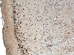 CACNG7 Rabbit anti-Human, Mouse, Rat, Polyclonal, Proteintech:Antibodies:Primary