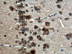 CACNG7 Rabbit anti-Human, Mouse, Rat, Polyclonal, Proteintech:Antibodies:Primary