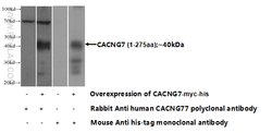 CACNG7 Rabbit anti-Human, Mouse, Rat, Polyclonal, Proteintech:Antibodies:Primary