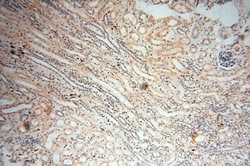 MMP8 Rabbit anti-Human, Mouse, Rat, Polyclonal, Proteintech:Antibodies:Primary