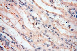 MMP8 Rabbit anti-Human, Mouse, Rat, Polyclonal, Proteintech:Antibodies:Primary