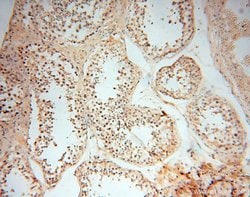 MMP8 Rabbit anti-Human, Mouse, Rat, Polyclonal, Proteintech:Antibodies:Primary