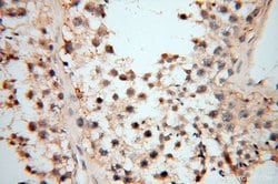 MMP8 Rabbit anti-Human, Mouse, Rat, Polyclonal, Proteintech:Antibodies:Primary