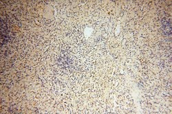 MMP8 Rabbit anti-Human, Mouse, Rat, Polyclonal, Proteintech:Antibodies:Primary