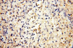 MMP8 Rabbit anti-Human, Mouse, Rat, Polyclonal, Proteintech:Antibodies:Primary