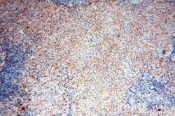 MMP8 Rabbit anti-Human, Mouse, Rat, Polyclonal, Proteintech:Antibodies:Primary