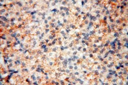 MMP8 Rabbit anti-Human, Mouse, Rat, Polyclonal, Proteintech:Antibodies:Primary