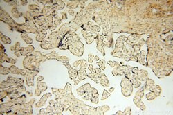 MMP8 Rabbit anti-Human, Mouse, Rat, Polyclonal, Proteintech:Antibodies:Primary