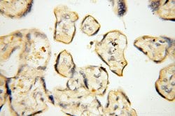 MMP8 Rabbit anti-Human, Mouse, Rat, Polyclonal, Proteintech:Antibodies:Primary