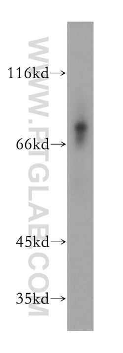 MMP8 Rabbit anti-Human, Mouse, Rat, Polyclonal, Proteintech:Antibodies:Primary