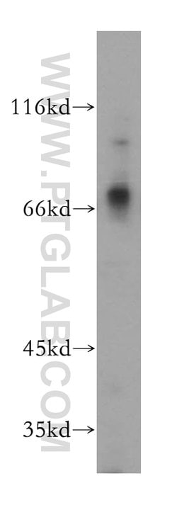MMP8 Rabbit anti-Human, Mouse, Rat, Polyclonal, Proteintech:Antibodies:Primary