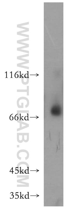 MMP8 Rabbit anti-Human, Mouse, Rat, Polyclonal, Proteintech:Antibodies:Primary