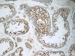 THOC7 Rabbit anti-Human, Mouse, Rat, Polyclonal, Proteintech 150 &mu;L | Buy Online | Proteintech Group Inc | Fisher Scientific