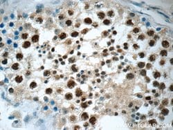 THOC7 Rabbit anti-Human, Mouse, Rat, Polyclonal, Proteintech 150 &mu;L | Buy Online | Proteintech Group Inc | Fisher Scientific