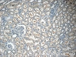 THOC7 Rabbit anti-Human, Mouse, Rat, Polyclonal, Proteintech 150 &mu;L | Buy Online | Proteintech Group Inc | Fisher Scientific