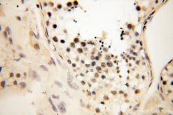 THOC7 Rabbit anti-Human, Mouse, Rat, Polyclonal, Proteintech 150 &mu;L | Buy Online | Proteintech Group Inc | Fisher Scientific