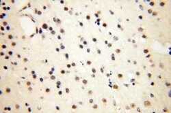 THOC7 Rabbit anti-Human, Mouse, Rat, Polyclonal, Proteintech 150 &mu;L | Buy Online | Proteintech Group Inc | Fisher Scientific