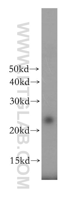 THOC7 Rabbit anti-Human, Mouse, Rat, Polyclonal, Proteintech 150 &mu;L | Buy Online | Proteintech Group Inc | Fisher Scientific