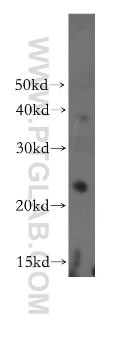 THOC7 Rabbit anti-Human, Mouse, Rat, Polyclonal, Proteintech 150 &mu;L | Buy Online | Proteintech Group Inc | Fisher Scientific