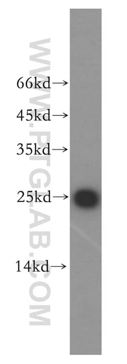 THOC7 Rabbit anti-Human, Mouse, Rat, Polyclonal, Proteintech 150 &mu;L | Buy Online | Proteintech Group Inc | Fisher Scientific