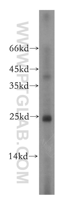 THOC7 Rabbit anti-Human, Mouse, Rat, Polyclonal, Proteintech 150 &mu;L | Buy Online | Proteintech Group Inc | Fisher Scientific