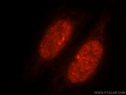 SLTM Rabbit anti-Human, Mouse, Rat, Polyclonal, Proteintech 150 &mu;L | Buy Online | Proteintech Group Inc | Fisher Scientific