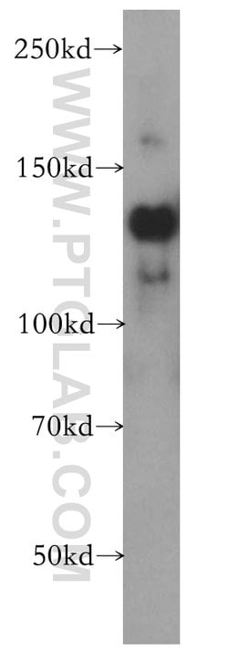 SLTM Rabbit anti-Human, Mouse, Rat, Polyclonal, Proteintech 150 &mu;L | Buy Online | Proteintech Group Inc | Fisher Scientific