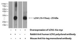 LCN1 Rabbit anti-Human, Polyclonal, Proteintech 150 &mu;L; Unconjugated:Antibodies,