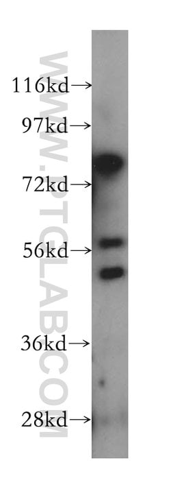 LPCAT4 Rabbit anti-Human, Mouse, Rat, Polyclonal, Proteintech:Antibodies:Primary