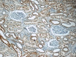 EPO Rabbit anti-Human, Polyclonal, Proteintech:Antibodies:Primary Antibodies