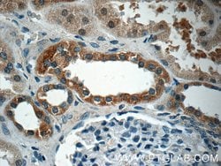 EPO Rabbit anti-Human, Polyclonal, Proteintech:Antibodies:Primary Antibodies