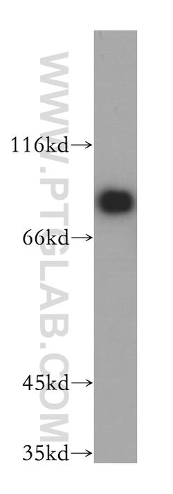 EIF4B Rabbit anti-Human, Mouse, Rat, Polyclonal, Proteintech:Antibodies:Primary
