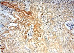 SNX5 Rabbit anti-Human, Mouse, Rat, Polyclonal, Proteintech 150 &mu;L;